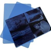 A4 14*17 inkjet dry imaging blue x-ray medical film for Epson Canon printers
