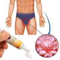 KanyeHB Wart Removal Ointment Genital Herpes Vulvar Condyloma Acuminatum Skin Tag Antibacterial Treatment Cream