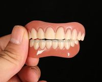 Upper and lower dentures Perfect Smile Veneers Comfort Fit Flex Denture Paste Double-row braces