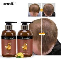 Fast-Result Hair Growth Shampoo Conditioner Helps Boost Volumizing Protection for Fragile Hair Loss Shampoo Rosemary Oil Hair Growth Kit